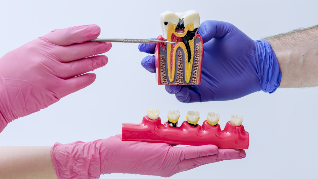 71776 - Professional Dental Blog