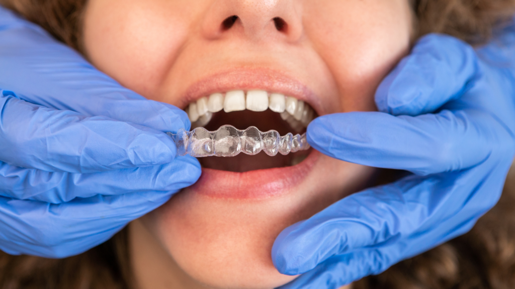 71780 - Professional Dental Blog