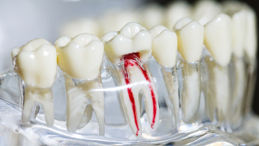 71861 - Professional Dental Blog