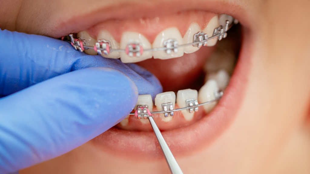 71856 - Professional Dental Blog